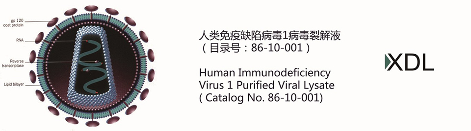 HIV Viral Lysate